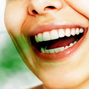 Woman smiling with an open mouth and straight teeth with a green odor blob coming out of her mouth showing bad breath