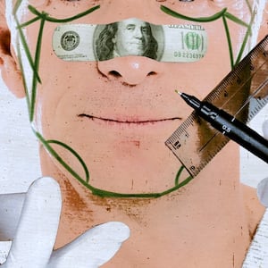 A man recieves mark-ups before a face lift.
