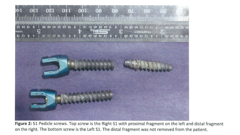 210806-KHN-implants-embed-01_yutgh5