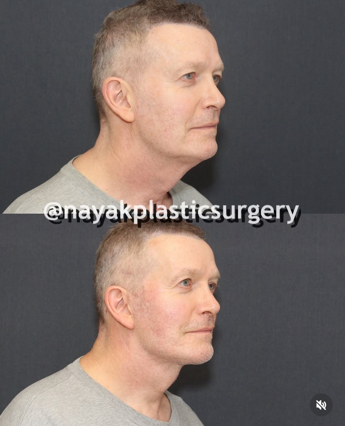 John Spaedy before-and-after photos.