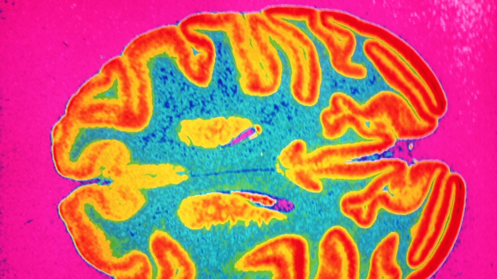 articles/2015/10/11/my-cancer-is-as-strange-as-my-fiction/151010-barnes-cancer-tease_jljtrq