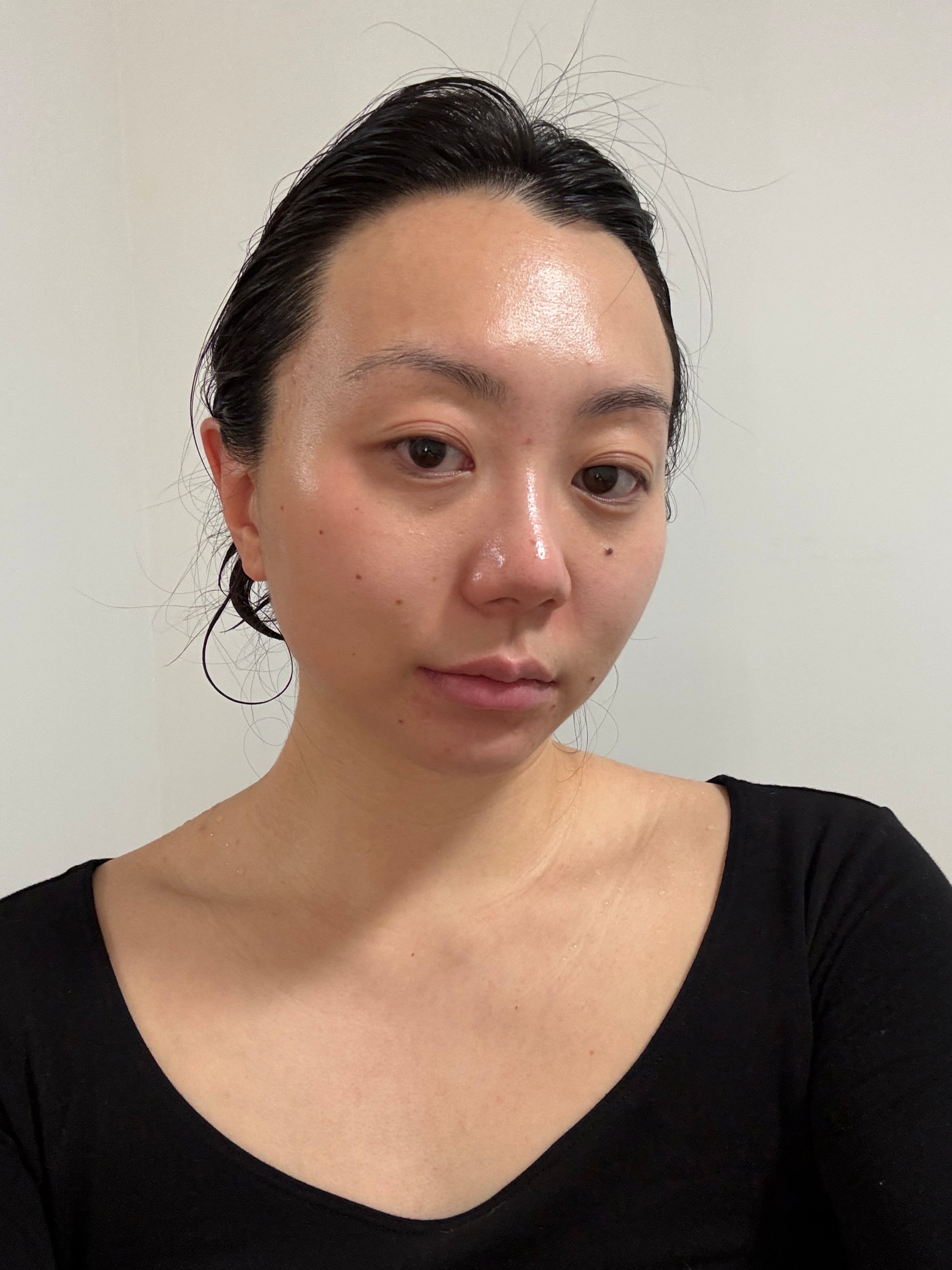 My skin after using Epionce's lightweight formula.