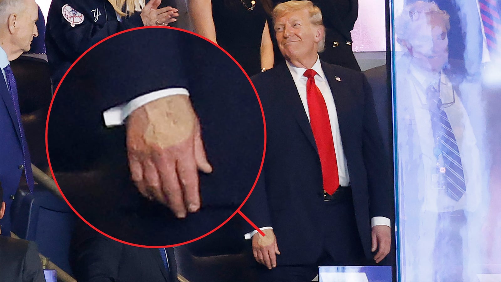 Donald Trump at the Yankees game with an inset to show makeup on his hand.