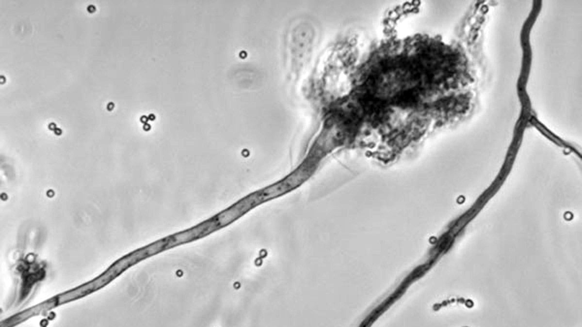 cheats/2012/10/16/meningitis-cases-spread-further/meningitis-micro-cheat_op3ge2