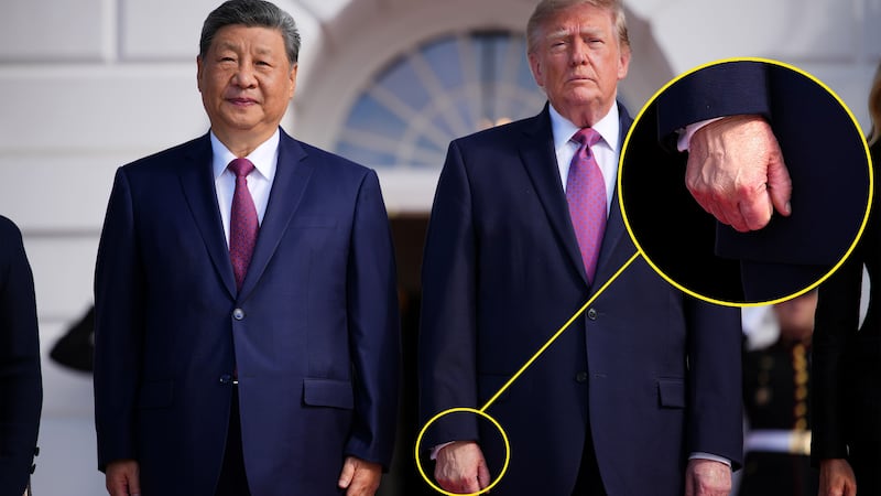 President Donald Trump's hand was visibly caked in makeup as he stood beside Chinese President Xi Jinping.