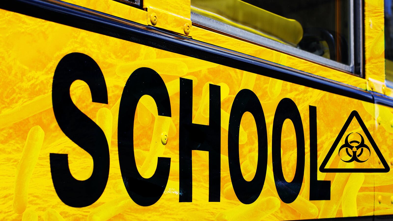 articles/2016/09/07/do-these-california-kids-have-leprosy/160902-warshaw-leprosy-california-tease_meuxay