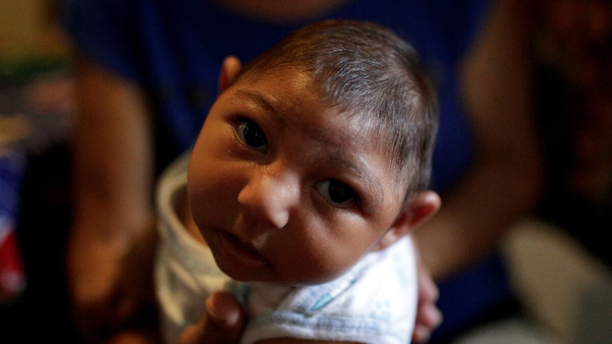 cheats/2016/12/14/vast-brain-defects-seen-in-zika-babies/161214-zikz-baby-brain-defect-cheat_fneeip