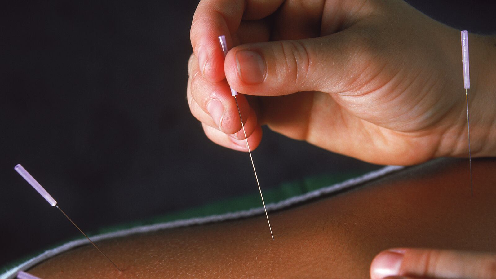 200912-Candida-grisly-backstory-acupuncture-tease_tdd3kq