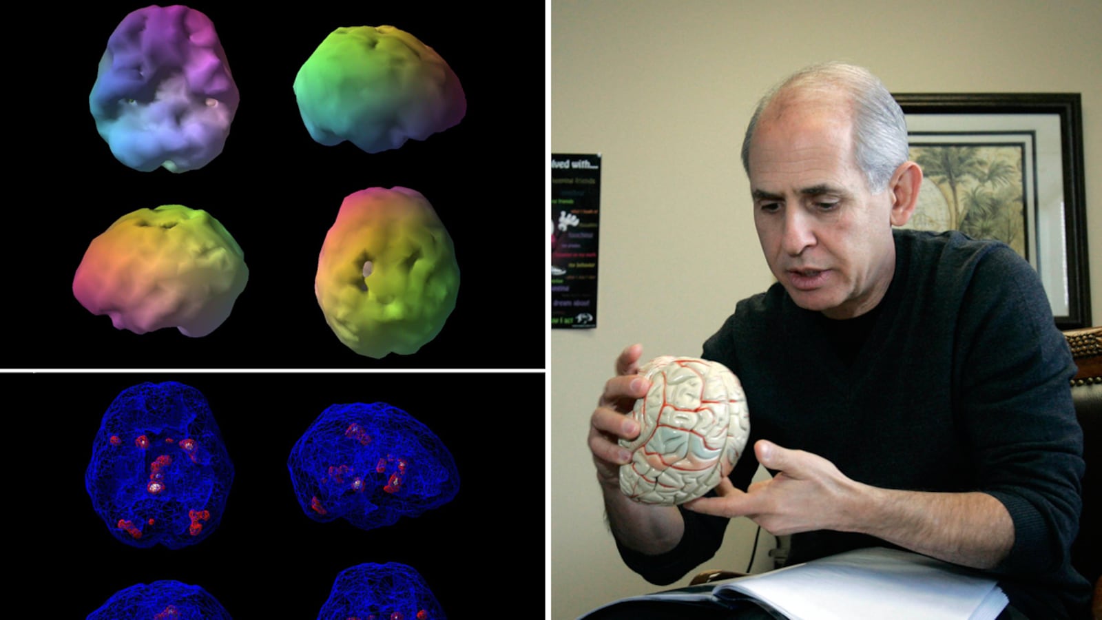 articles/2012/12/14/can-daniel-amen-read-your-mind/shapiro-brain-scan-tease-embed_xaolfs