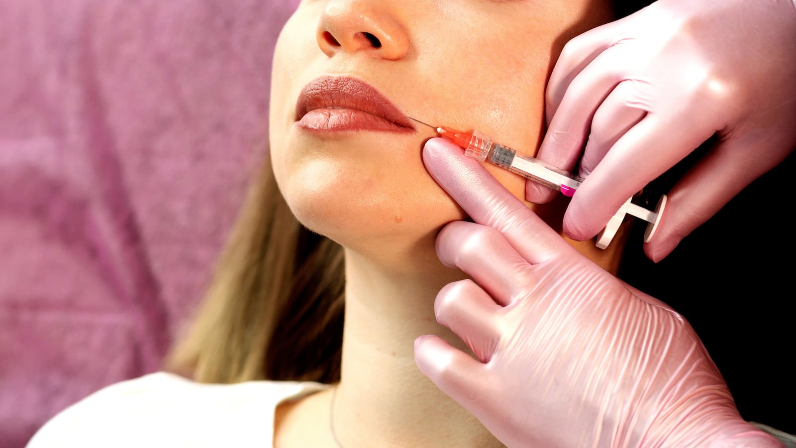 A woman (not Andrea Ivanova) receives lip injections from a practitioner.