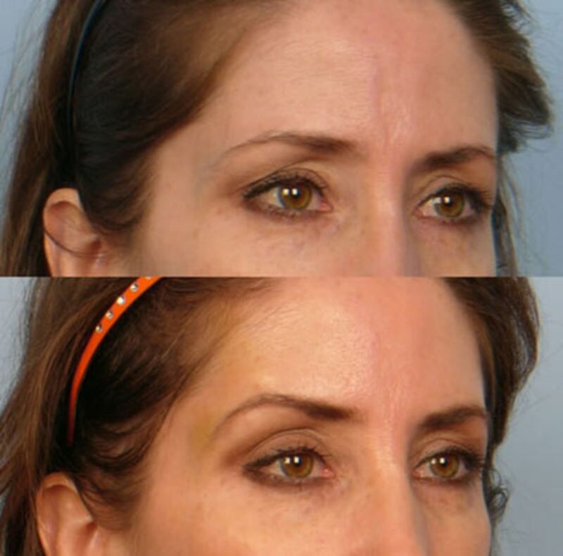 galleries/2011/12/23/neti-pots-and-other-worst-oprah-winfrey-endorsements-photos/oprah-worst-endorsements-gal-thread-lift_shf76g