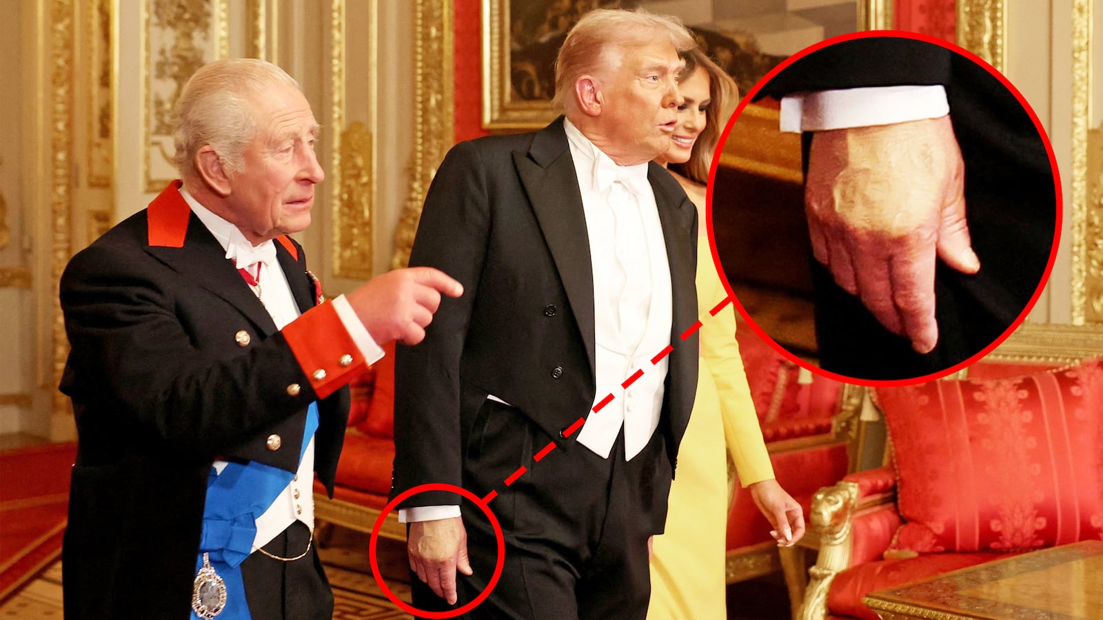 Red circle around Trump's hand makeup. Britain's King Charles, U.S. President Donald Trump and first lady Melania Trump walk to attend the State Banquet during U.S. President Donald Trump's state visit, at Windsor Castle, in Windsor, Britain, September 17, 2025.