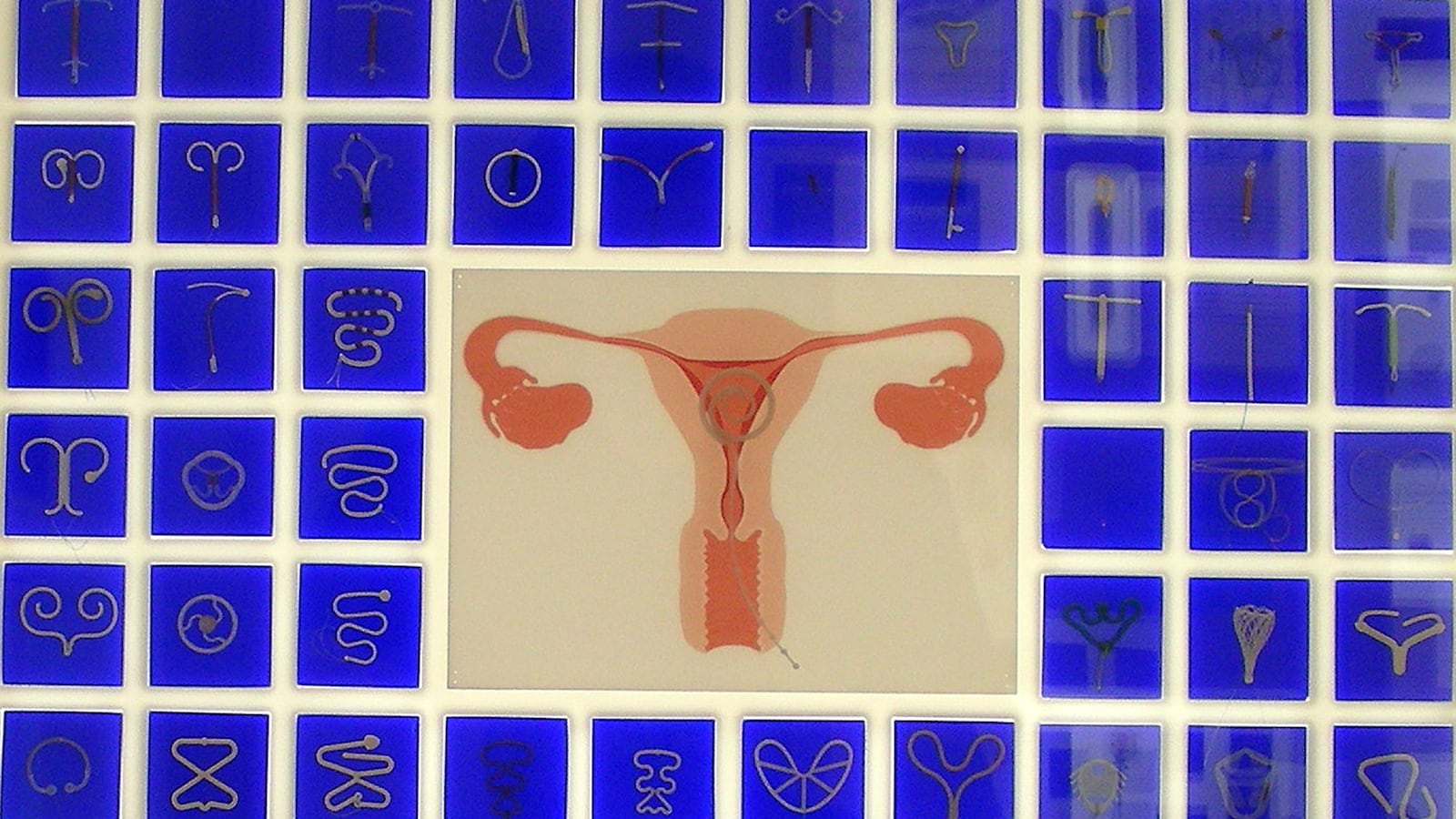 articles/2015/08/29/a-trip-to-vienna-s-abortion-museum/150828-kirkam-abortion-museum-tease_qmljog