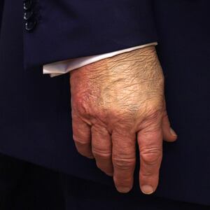 A detailed view of the hand of President Donald Trump as he speaks in the Oval Office at the White House on Sept. 2, 2025 in Washington, DC.