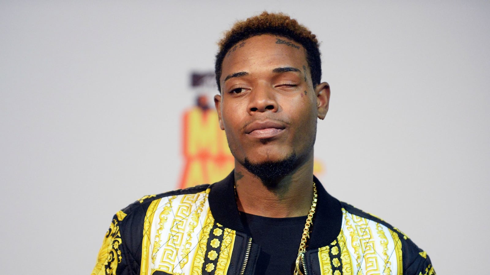 cheats/2015/09/26/fetty-wap-injured-in-motorcycle-crash/150926-fetty-wap-cheat_uq4jt5