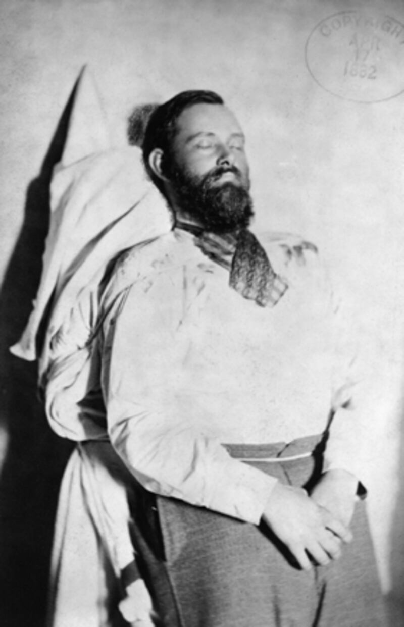 galleries/2011/05/03/famous-remains/famous-remains---jesse-james_vnjbpi