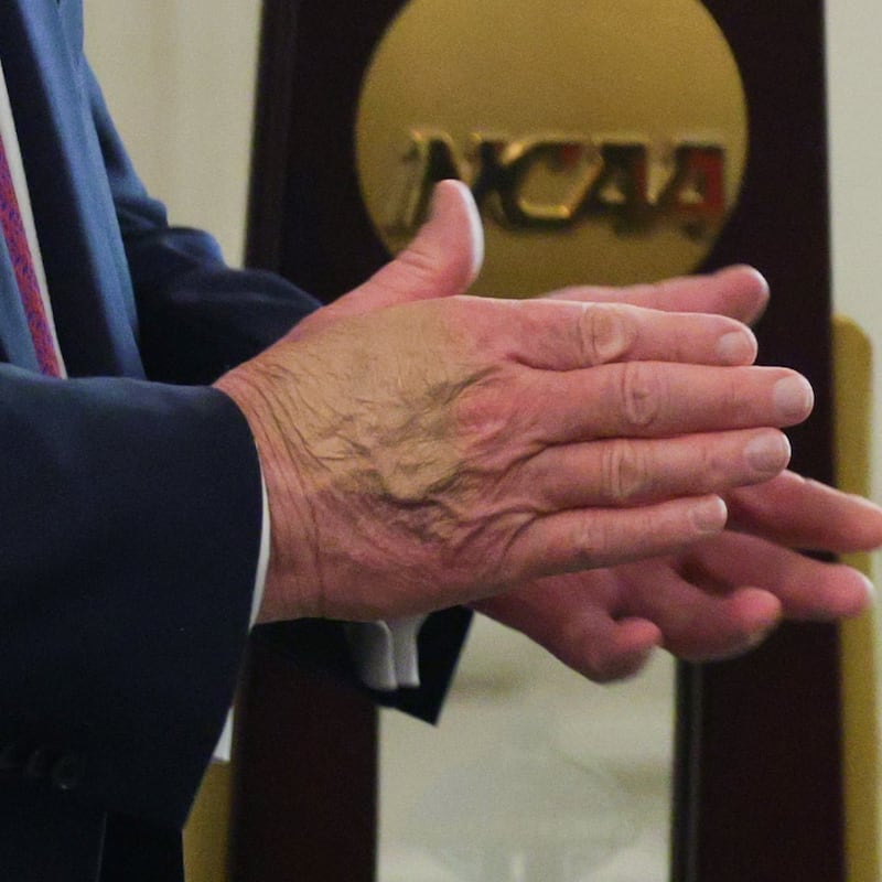 Donald trump hand bruise makeup