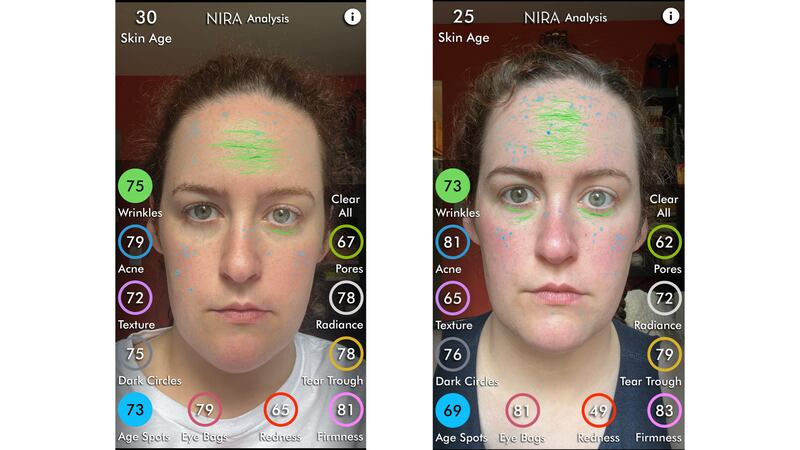 Two photos of the author's face, marked up with colorful lines and dots to indicate imperfections. The left is a before image, the right is an after. The changes are subtle.