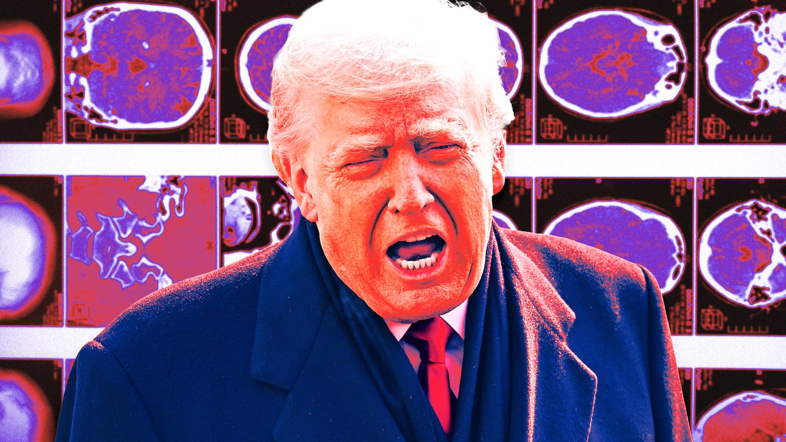 A photo illustration of Donald Trump in front of generic brain scans.