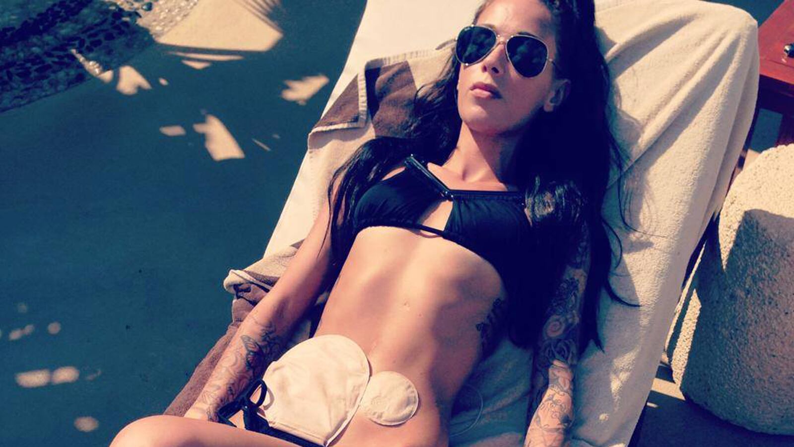 articles/2014/07/02/the-brave-colostomy-bag-selfies/140701-lytton-chrons-tease_d9zy1c