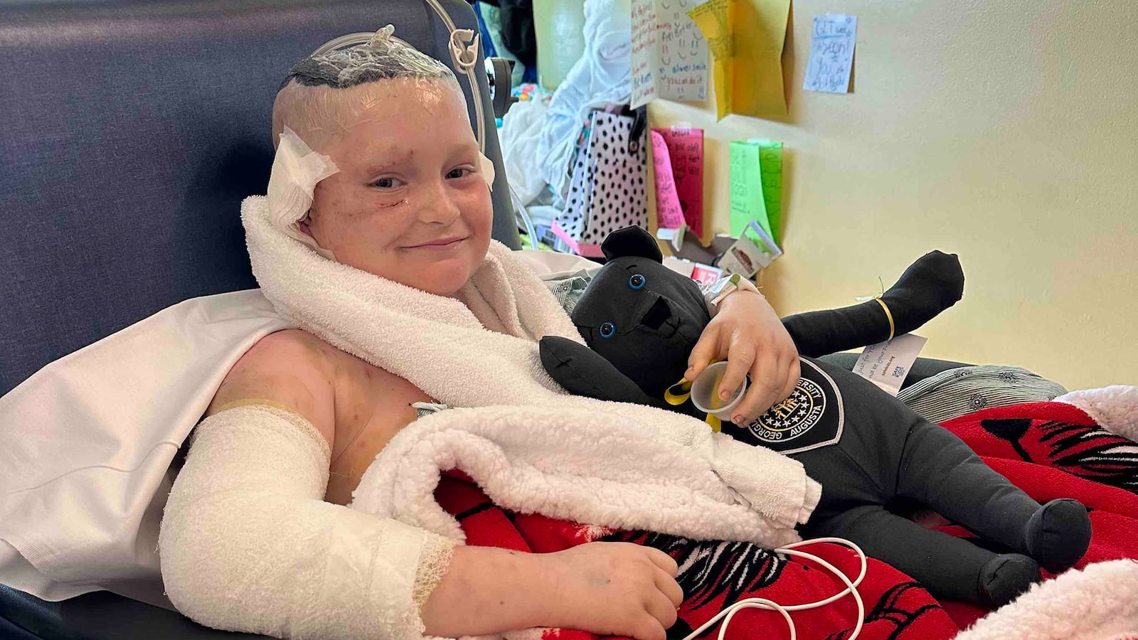 georgia-boy-mauled-pitbulls-heartbreaking-video-02_ikscbe