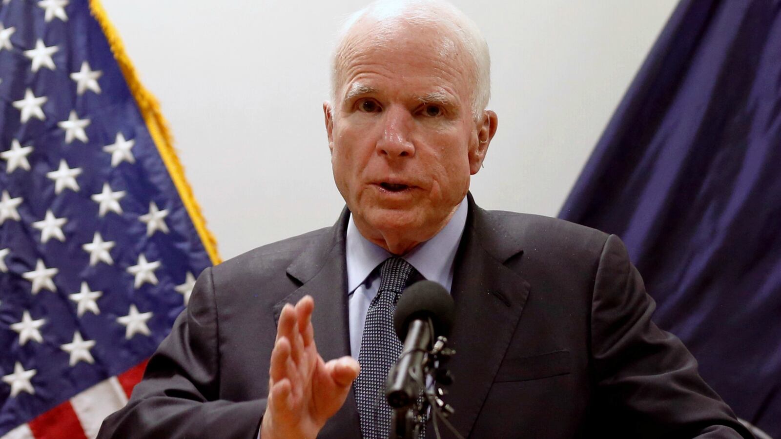 170716-john-mccain-craniotomy-recovery-cheat_amhcui