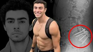 Luigi Mangione’s Reddit Page Lays Out Long List of Ailments