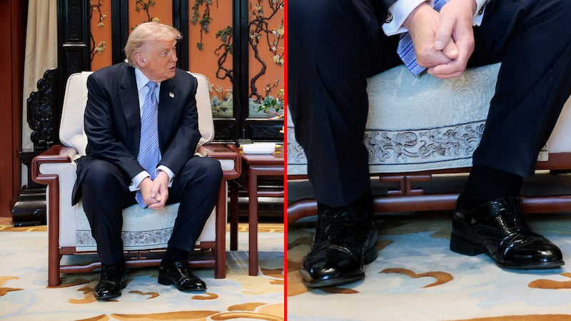 A close-up of Trump's cankles during his meeting with Chinese President Xi Jinping.