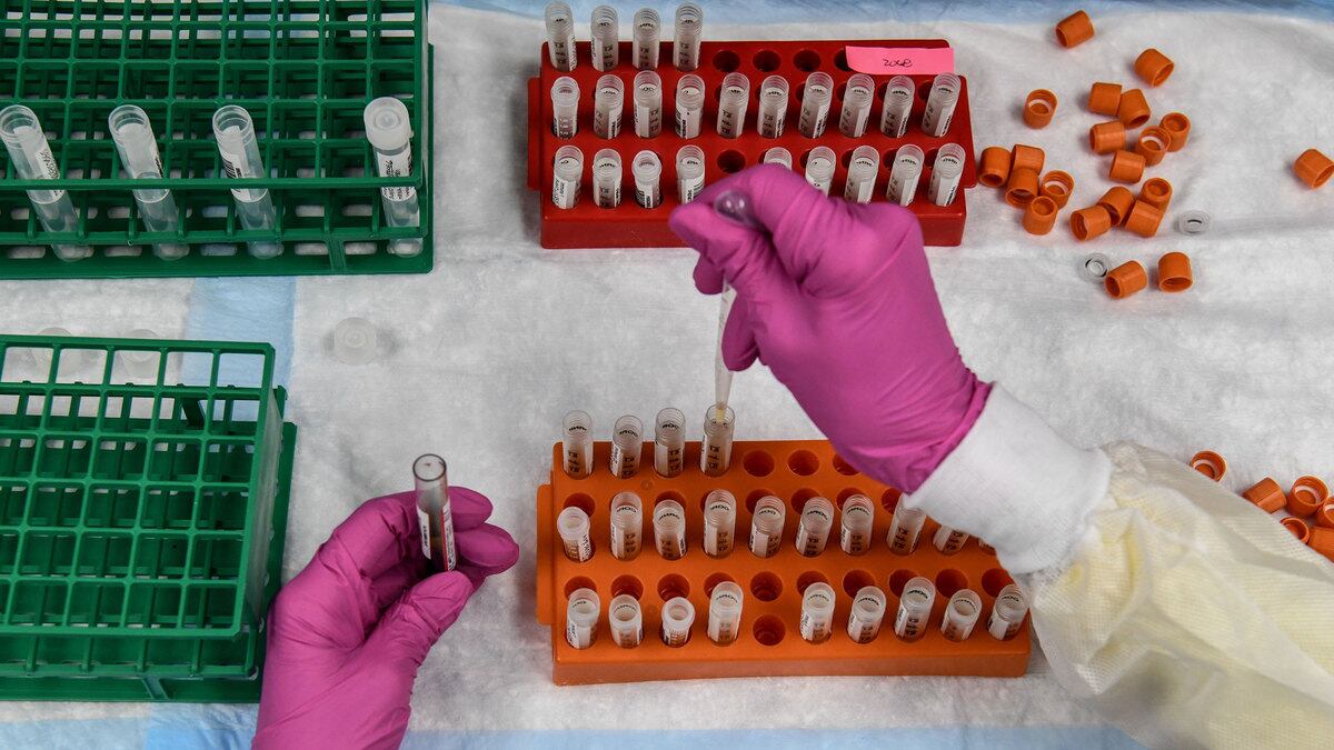 200903-coronavirus-vitamin-d-hero_q0z2wu