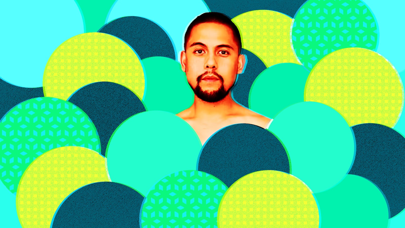 Jon Michael shares his struggle with gynecomastia.