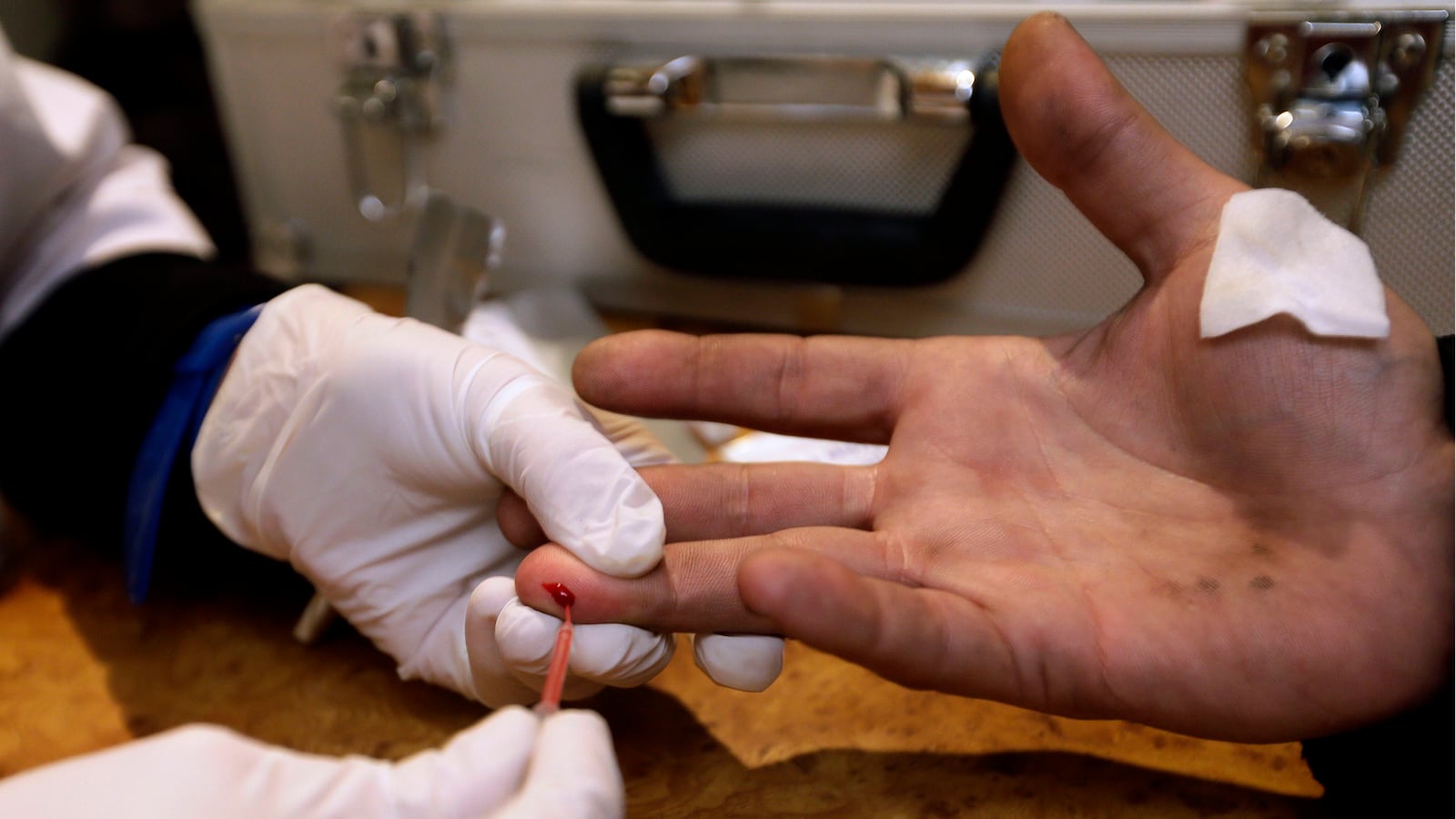 articles/2013/08/14/the-porn-industry-s-hepatitis-problem/130813-snow-hep-tease_arik9j