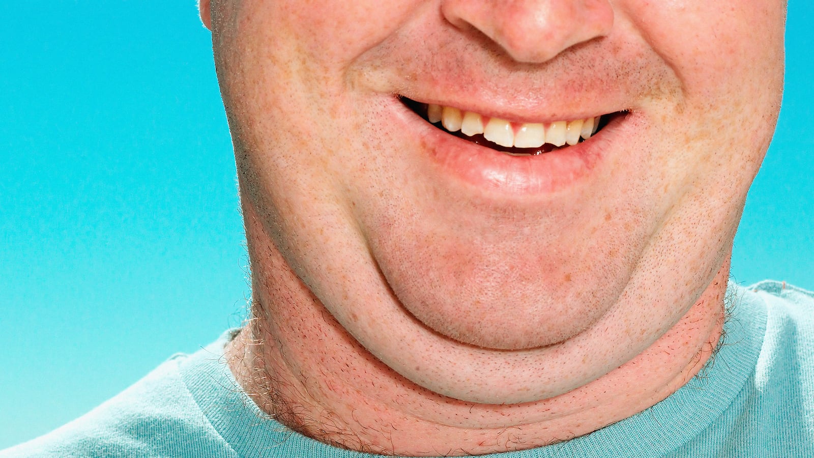 articles/2013/09/17/kythera-helps-you-melt-your-double-chin-no-diet-or-surgery-required/130917-gross-double-chin-tease-embed_s3j4ak