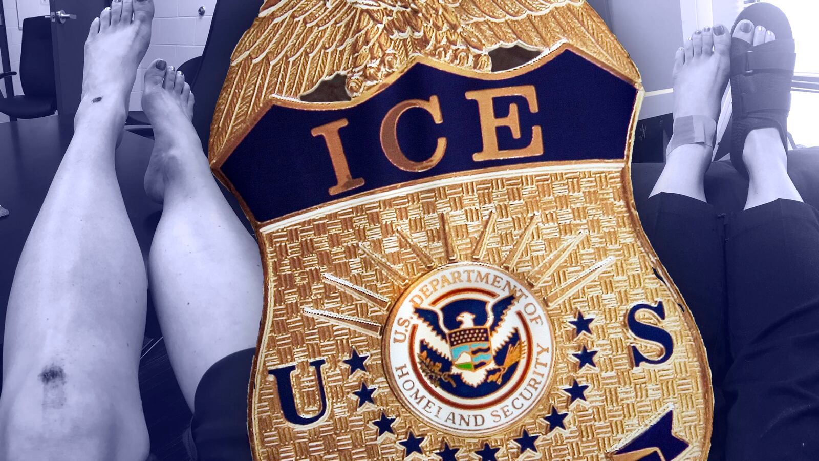 180626-woodruff-ice-broken-foot-tease2_kidtq3