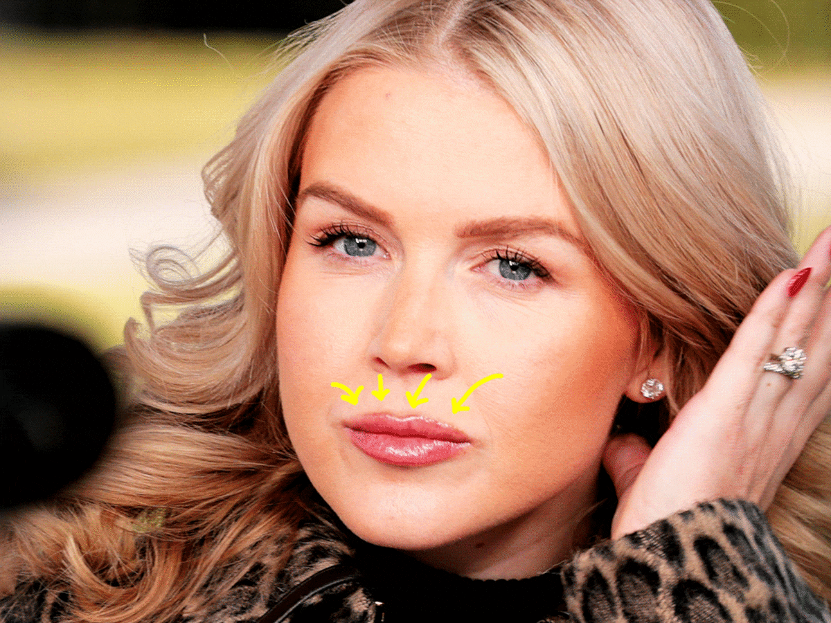 Karoline Leavitt's Cosmetic Secrets Brutally Exposed in Vanity Fair Shoot