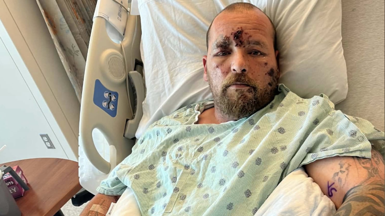 Jason’s daughter Ashley Turner shared this image of her dad after the horrific incident.