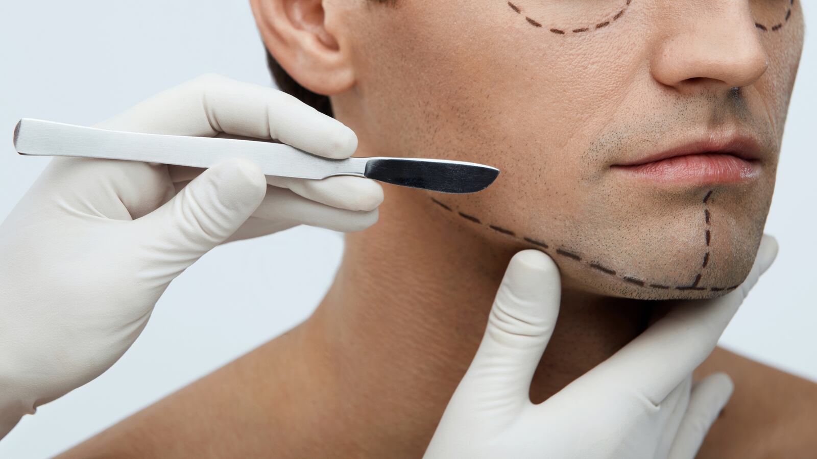 A man undergoes a cosmetic surgery consultation, with markings drawn onto his face.