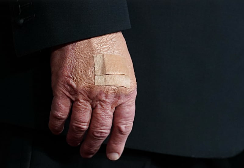 Close-up image of Donald Trump's bandaged hand.