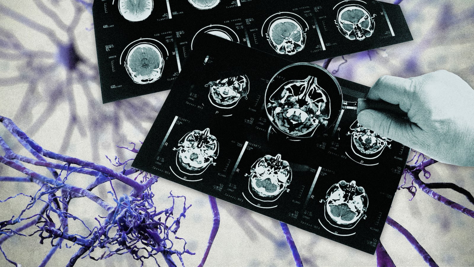 220706-Spichak-brain-tease_osf3y5