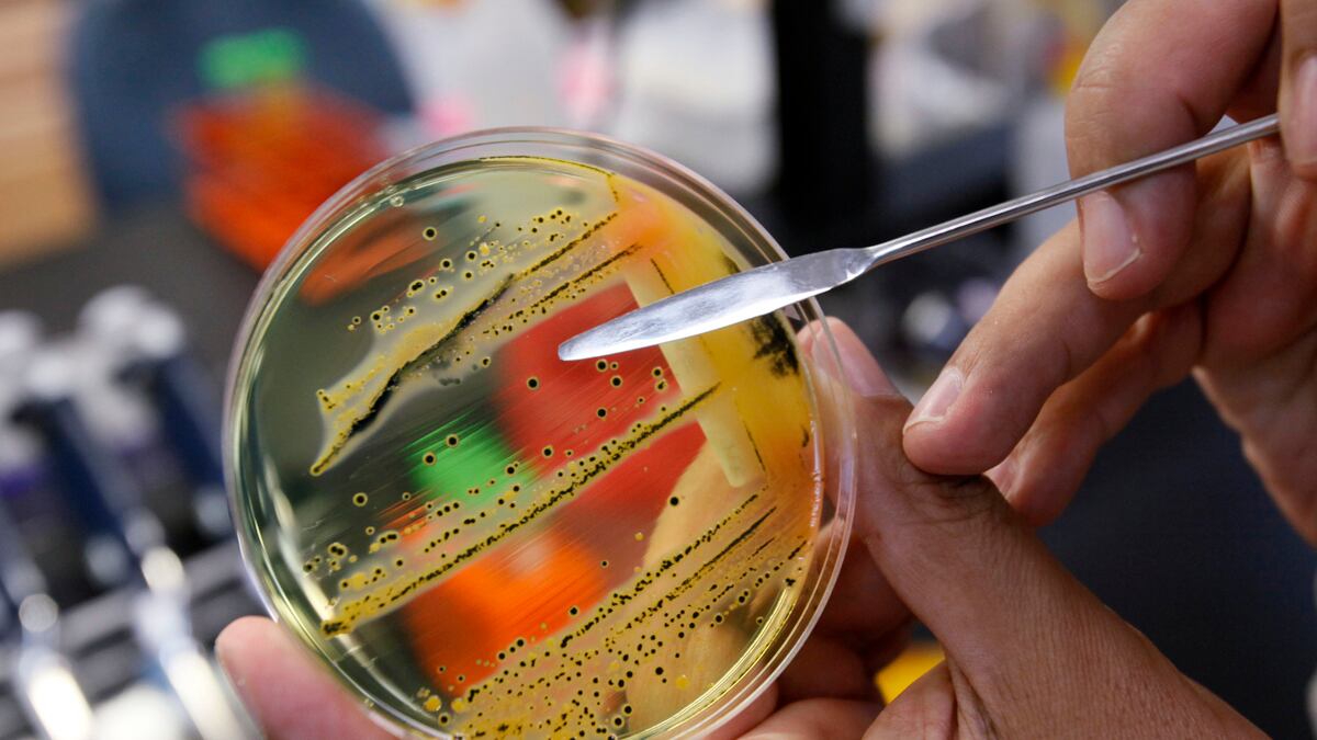 cheats/2011/08/03/salmonella-surge-linked-to-meat-giant/salmonella-cheat_bnq35m