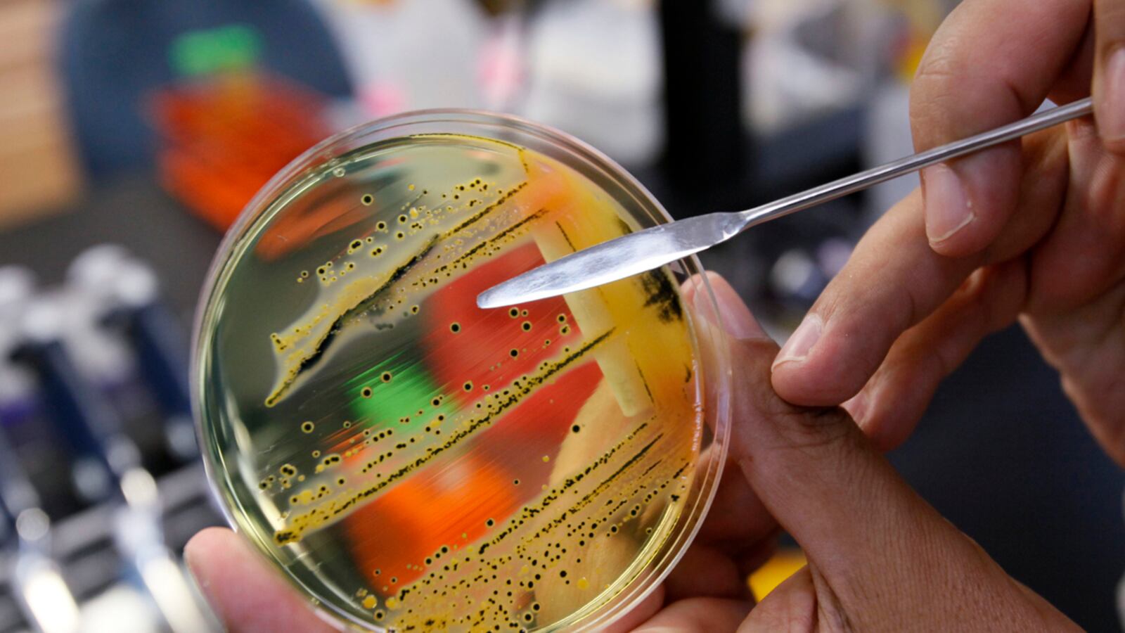 cheats/2011/08/03/salmonella-surge-linked-to-meat-giant/salmonella-cheat_bnq35m