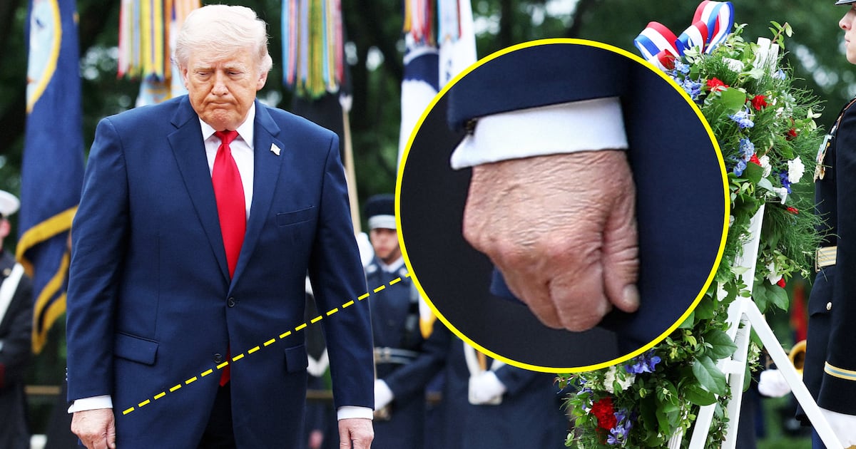 Trump, 79, Hides Bruises and Rests Eyes on Eve of Hospital Visit