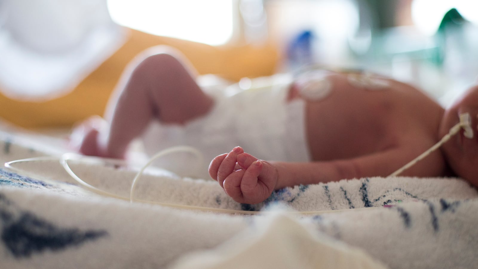 articles/2014/03/07/the-hiv-cured-baby-distorts-hope/140307-hiv-baby-sepkowitz-tease_tnehpt