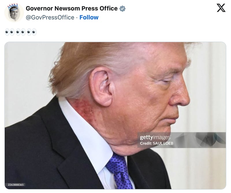 The Newsom Press Office were quick to zoom in on Trump's angry neck rash.