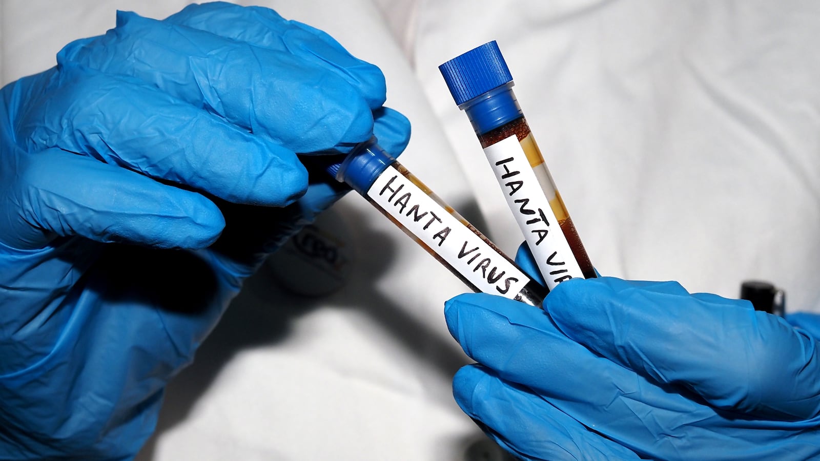 hantavirus
