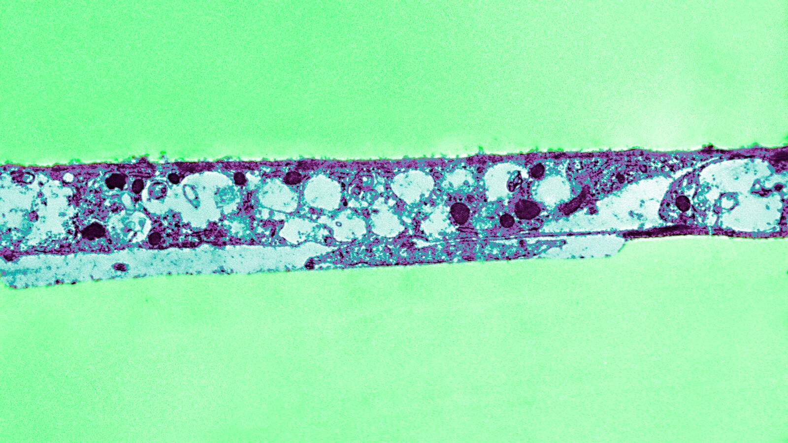 Syphilis Bacterium on cotton tail rabbit culture