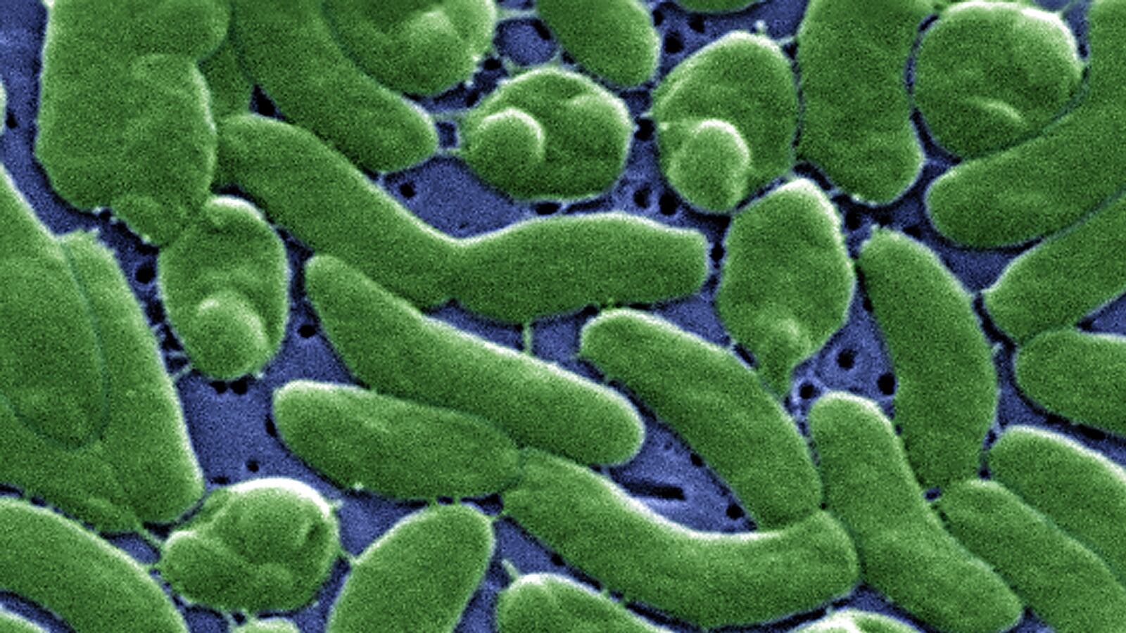 articles/2013/10/08/inside-florida-s-battle-with-the-flesh-eating-vibrio-vunlificus/131007-flesh-eating-bacteria-goddard-tease_v9hoik