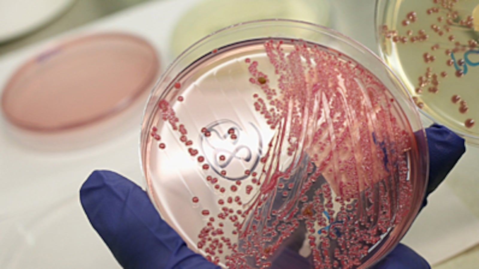 articles/2010/08/12/superbug-facts-to-know-as-ndm-1-emerges/superbug_185151_qsoidl