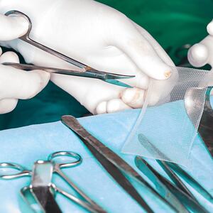 surgeons holding surgical mesh british medical mid urethral sling journal ulf ulmsten jonathan gornall johnson & johnson ethicon tmt vagina vaginal mesh implant transvaginal