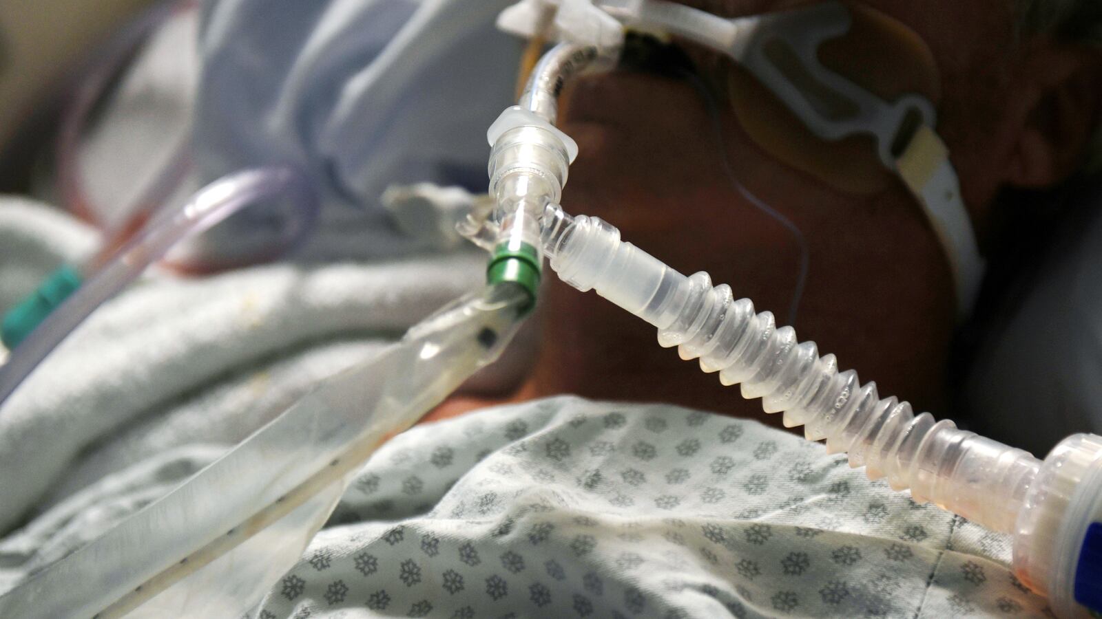 2021-01-28T100610Z_1008963260_RC2YGL9HIYM7_RTRMADP_3_GETINGE-RESULTS_ilcsva