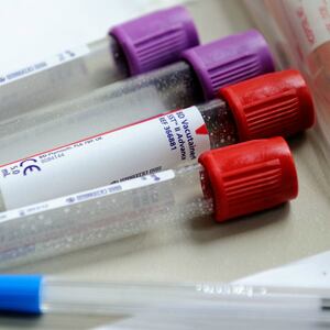 GettyImages-168758045_1_x1evbm